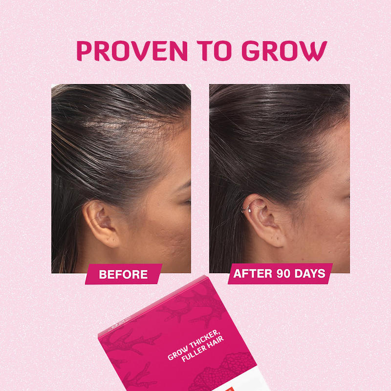 Saç Büyüme Tabletleri 120mcg Saç Büyümesi İçin Biotin Saç Büyüme Ürünü