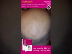 Kırmızı Saç Büyütme Tabletleri